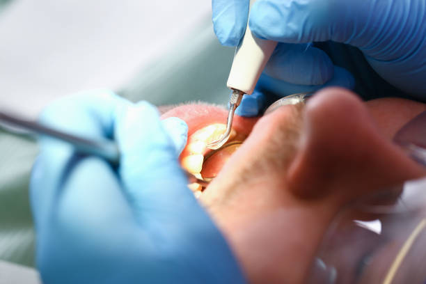 Urgent Tooth Repair in OH