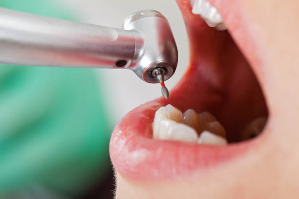 Best Urgent Tooth Repair  in Lima, OH